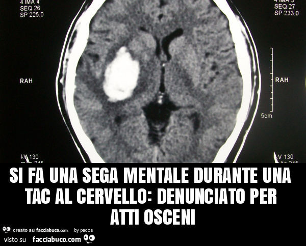 Si fa una sega mentale durante una tac al cervello: denunciato per atti osceni
