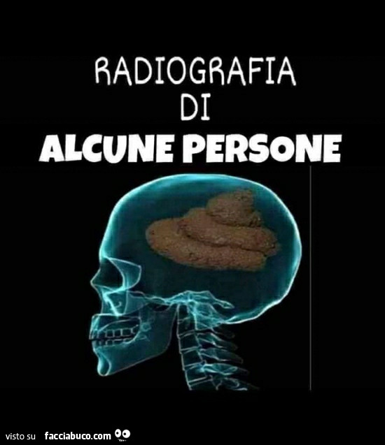 Radiografia di alcune persone